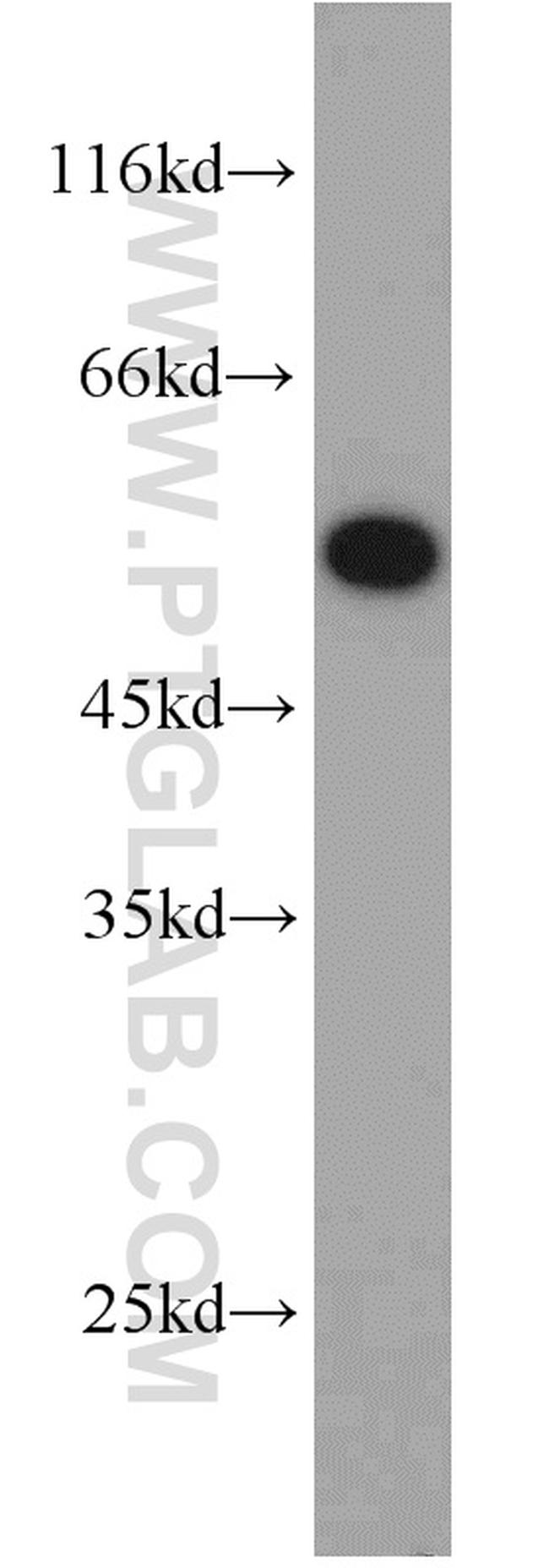 PSMC1 Antibody in Western Blot (WB)