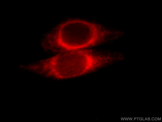 ORM2 Antibody in Immunocytochemistry (ICC/IF)