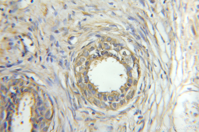 ORM2 Antibody in Immunohistochemistry (Paraffin) (IHC (P))