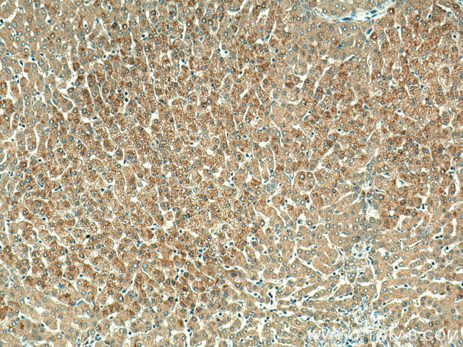 ORM2 Antibody in Immunohistochemistry (Paraffin) (IHC (P))