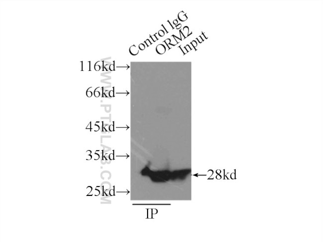 ORM2 Antibody in Immunoprecipitation (IP)