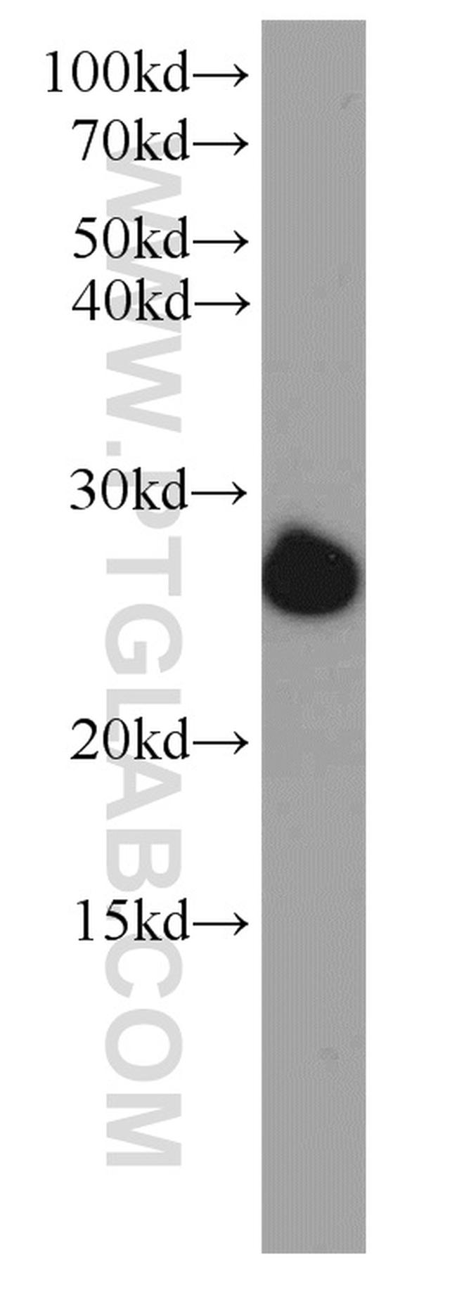 ORM2 Antibody in Western Blot (WB)