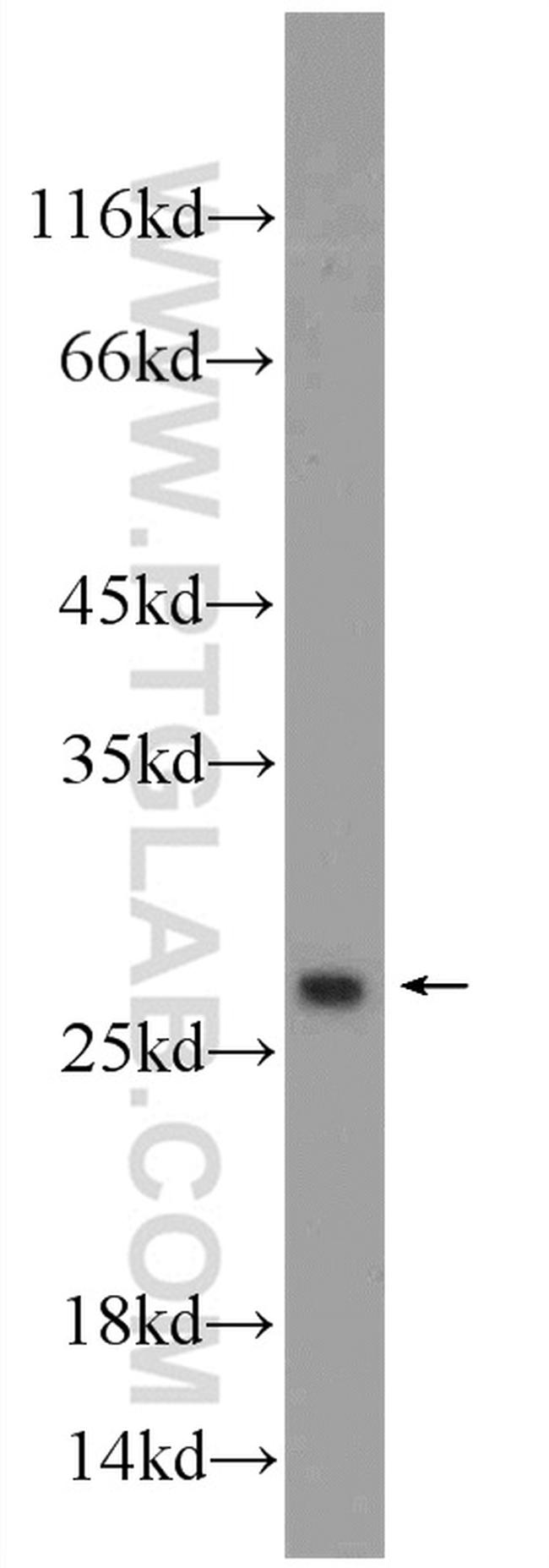 ORM2 Antibody in Western Blot (WB)