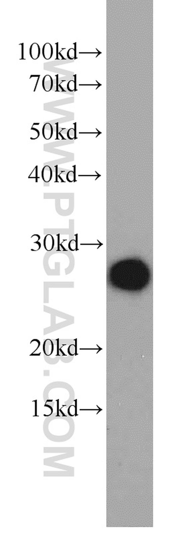 ORM2 Antibody in Western Blot (WB)