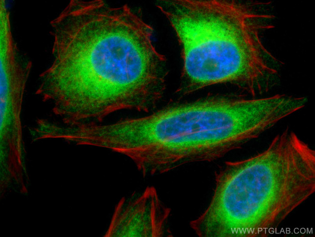 BAP31 Antibody in Immunocytochemistry (ICC/IF)