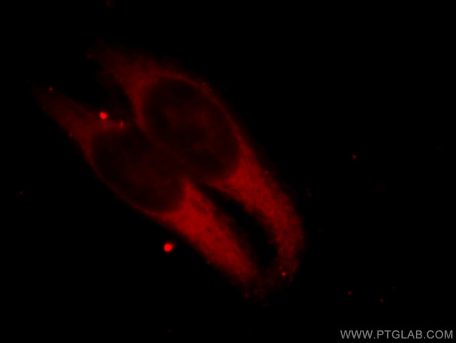 BAP31 Antibody in Immunocytochemistry (ICC/IF)