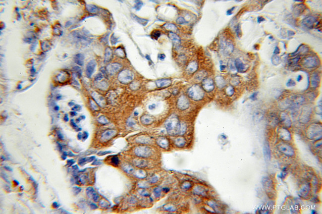 BAP31 Antibody in Immunohistochemistry (Paraffin) (IHC (P))