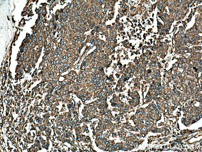 BAP31 Antibody in Immunohistochemistry (Paraffin) (IHC (P))