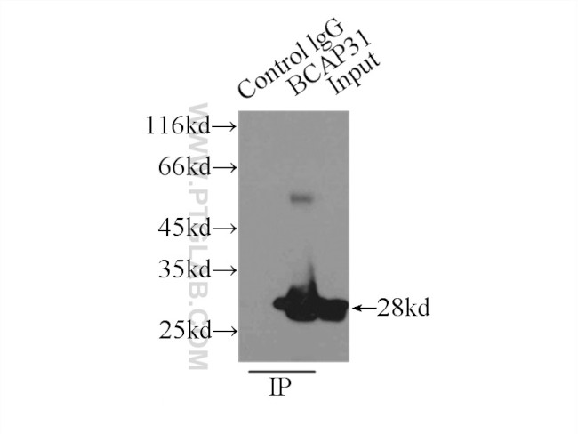 BAP31 Antibody in Immunoprecipitation (IP)