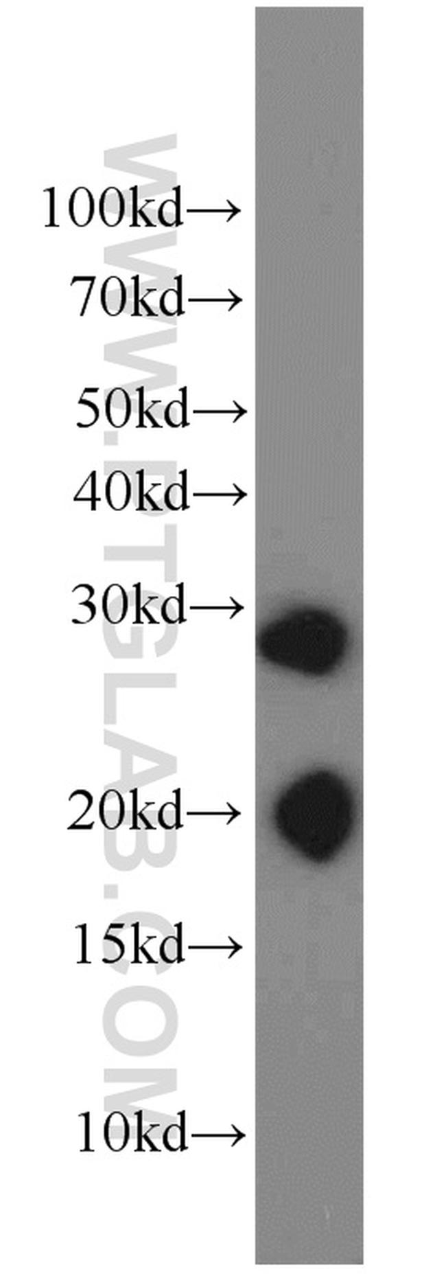 BAP31 Antibody in Western Blot (WB)