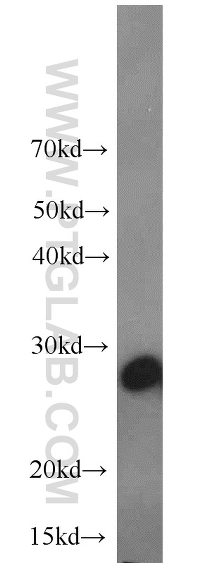 BAP31 Antibody in Western Blot (WB)