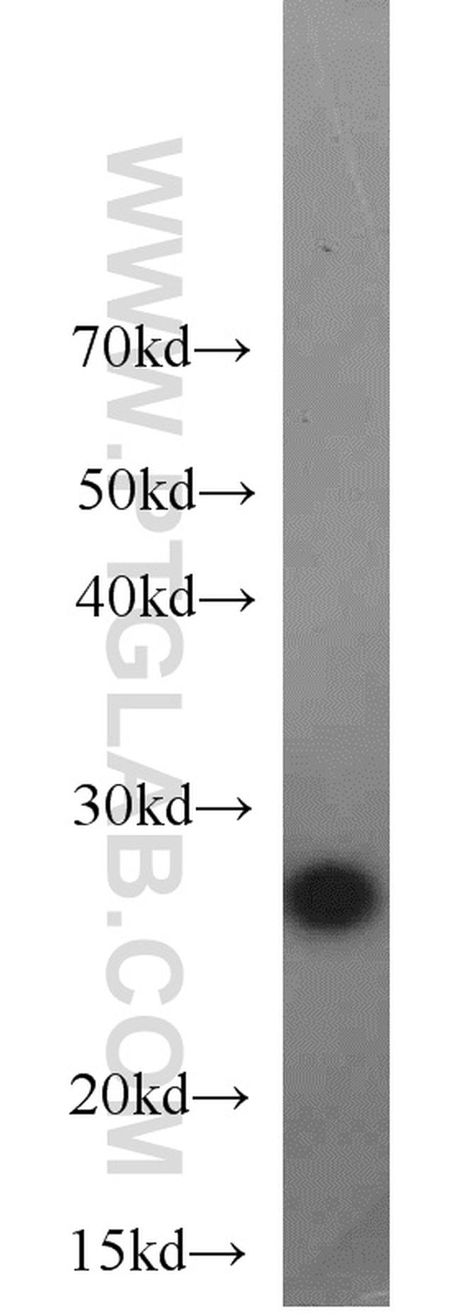 BAP31 Antibody in Western Blot (WB)