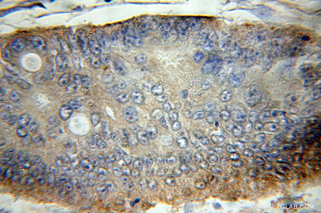 Syntaxin 16 Antibody in Immunohistochemistry (Paraffin) (IHC (P))