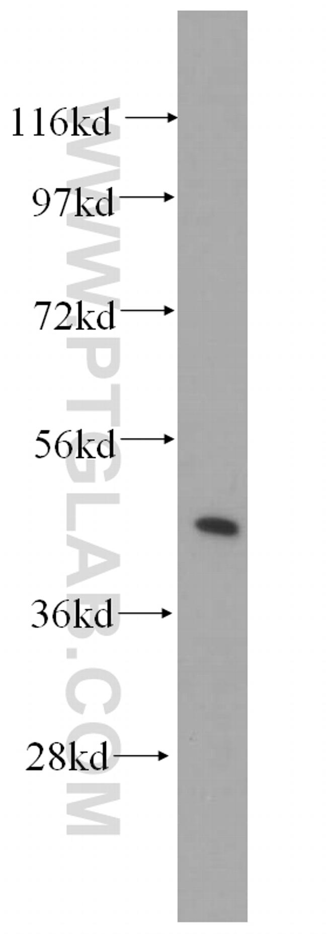 Syntaxin 16 Antibody in Western Blot (WB)