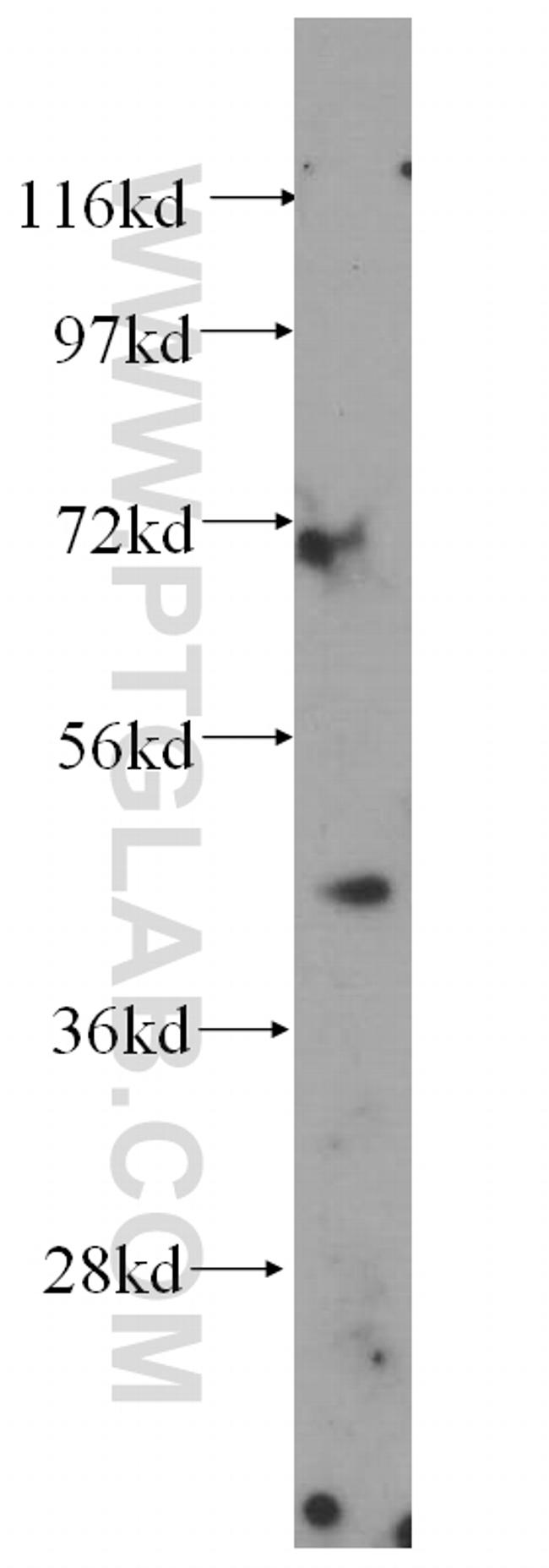 Syntaxin 16 Antibody in Western Blot (WB)