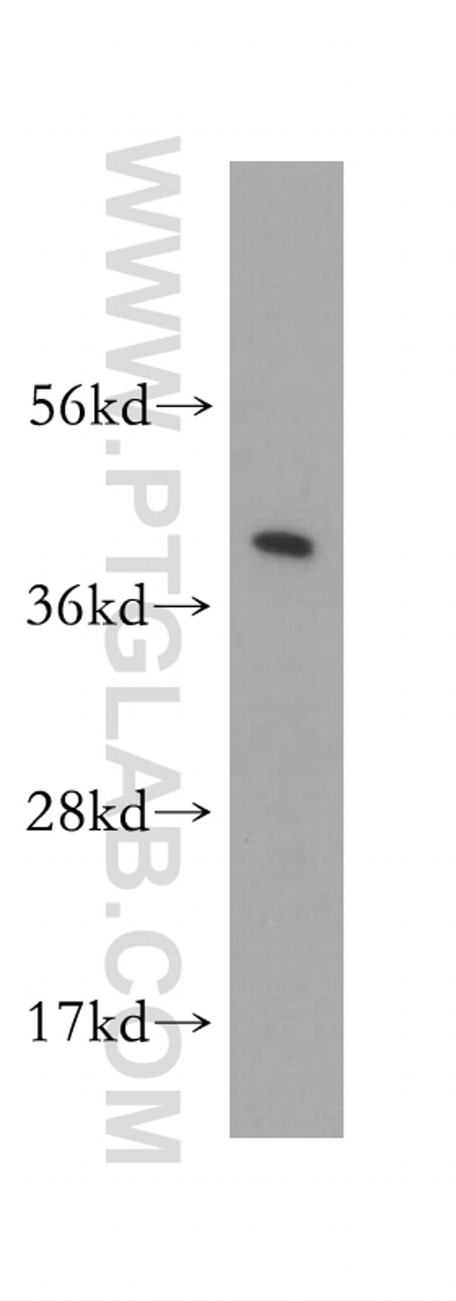 Actopaxin Antibody in Western Blot (WB)