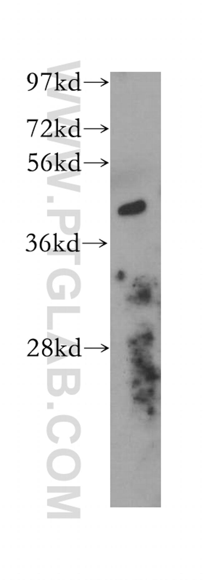 Actopaxin Antibody in Western Blot (WB)