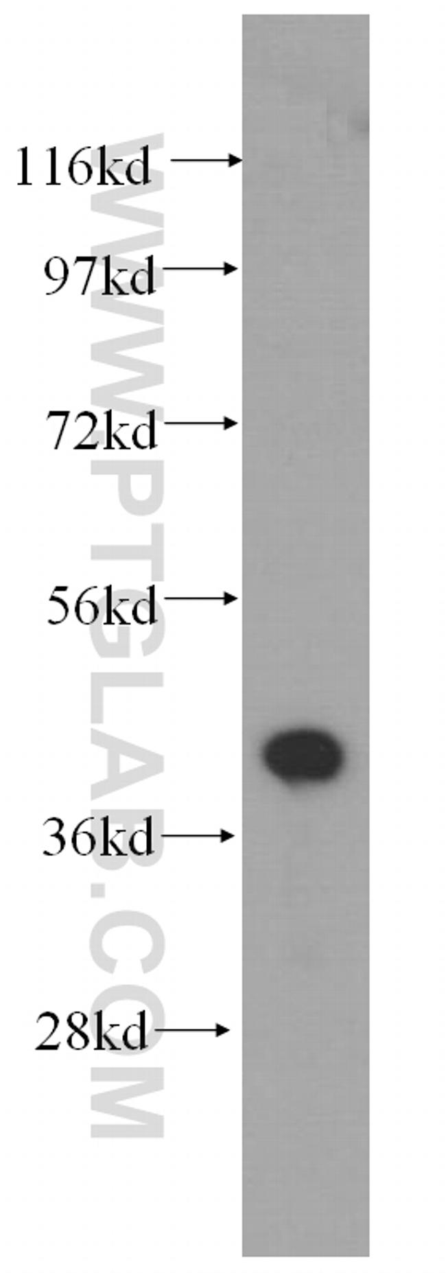 Actopaxin Antibody in Western Blot (WB)