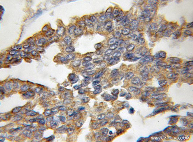 TXNL6 Antibody in Immunohistochemistry (Paraffin) (IHC (P))