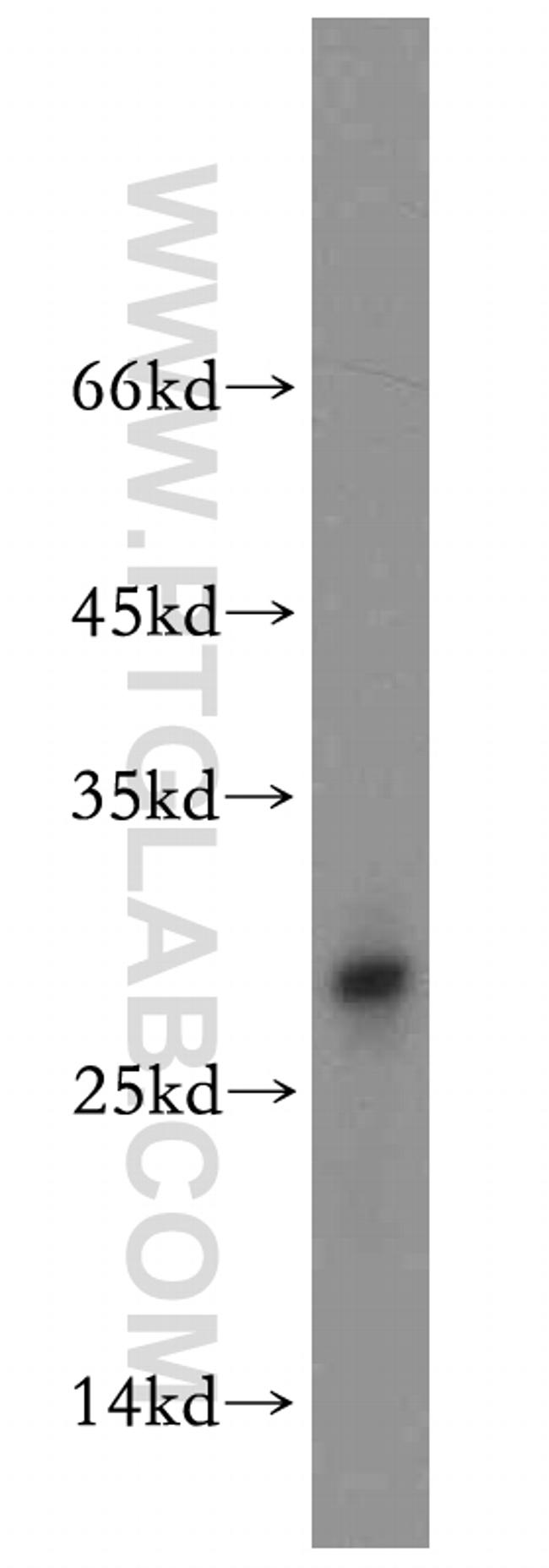 TXNL6 Antibody in Western Blot (WB)