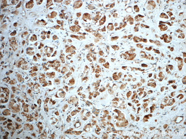 TXNL6 Antibody in Immunohistochemistry (Paraffin) (IHC (P))