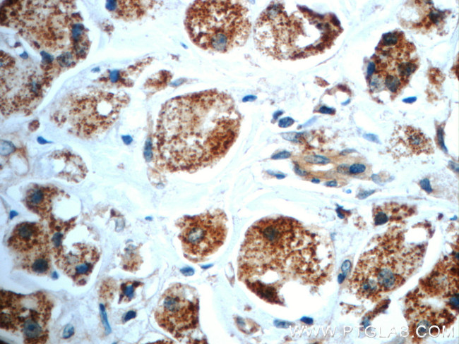 TXNL6 Antibody in Immunohistochemistry (Paraffin) (IHC (P))