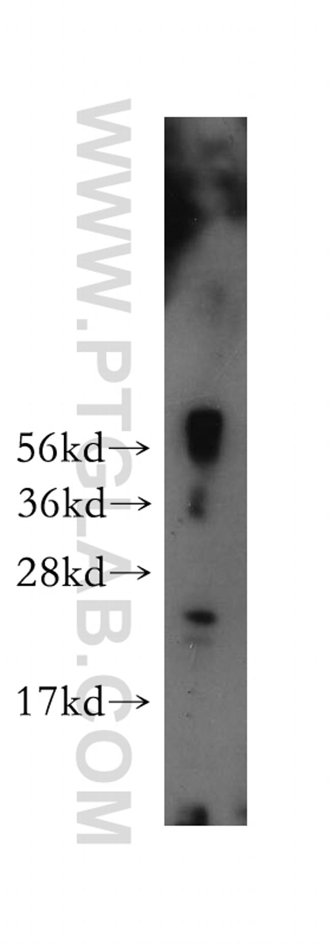 TXNL6 Antibody in Western Blot (WB)