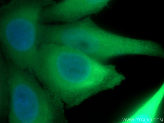 ENO1 Antibody in Immunocytochemistry (ICC/IF)