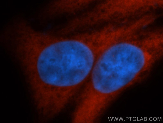 ENO1 Antibody in Immunocytochemistry (ICC/IF)