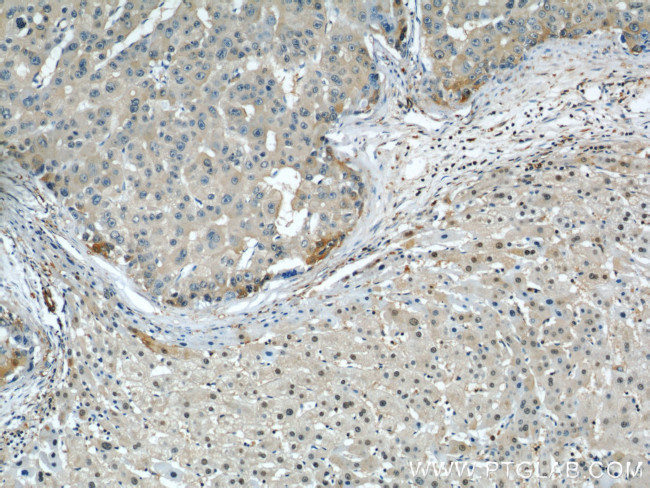 ENO1 Antibody in Immunohistochemistry (Paraffin) (IHC (P))