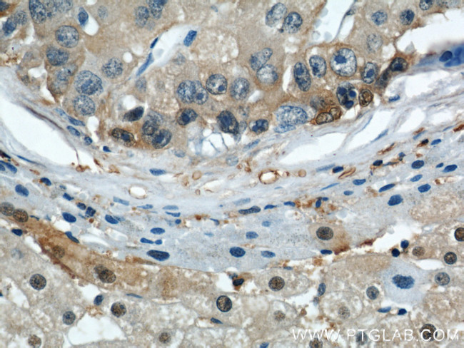 ENO1 Antibody in Immunohistochemistry (Paraffin) (IHC (P))