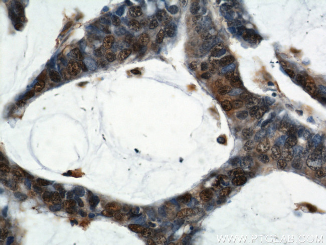 ENO1 Antibody in Immunohistochemistry (Paraffin) (IHC (P))