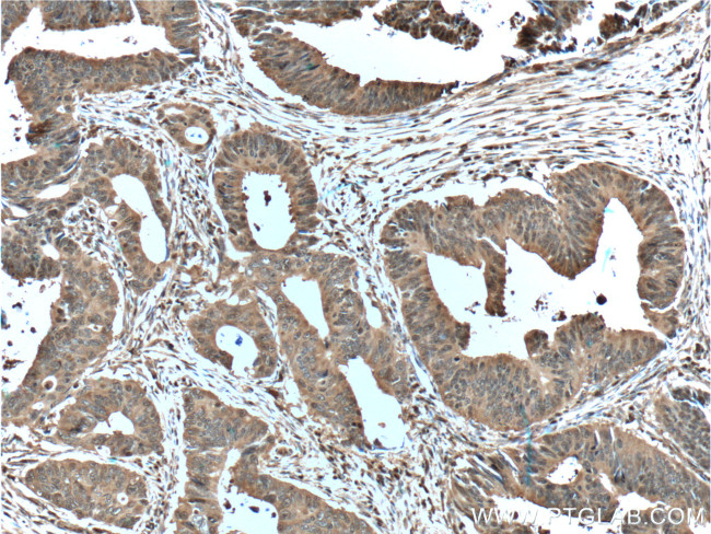 ENO1 Antibody in Immunohistochemistry (Paraffin) (IHC (P))