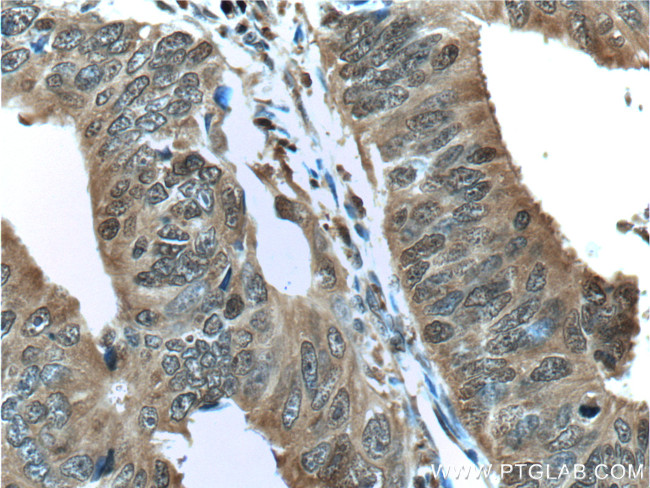 ENO1 Antibody in Immunohistochemistry (Paraffin) (IHC (P))