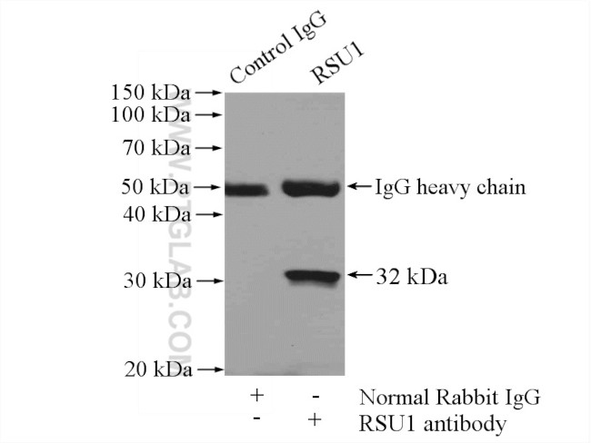 RSU1 Antibody in Immunoprecipitation (IP)