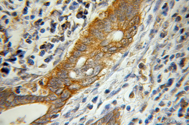 Pancreatic Lipase Antibody in Immunohistochemistry (Paraffin) (IHC (P))