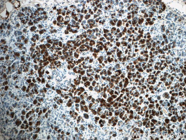 Pancreatic Lipase Antibody in Immunohistochemistry (Paraffin) (IHC (P))