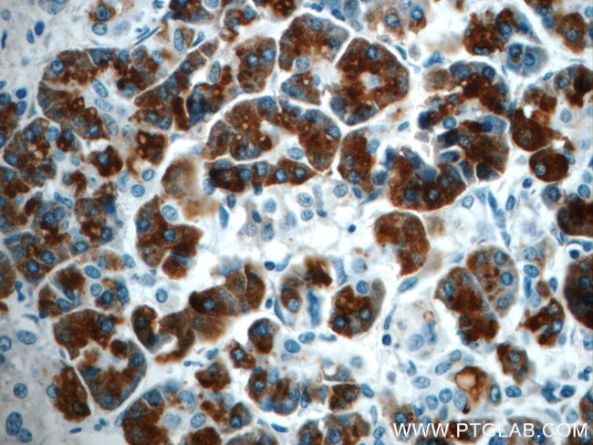 Pancreatic Lipase Antibody in Immunohistochemistry (Paraffin) (IHC (P))