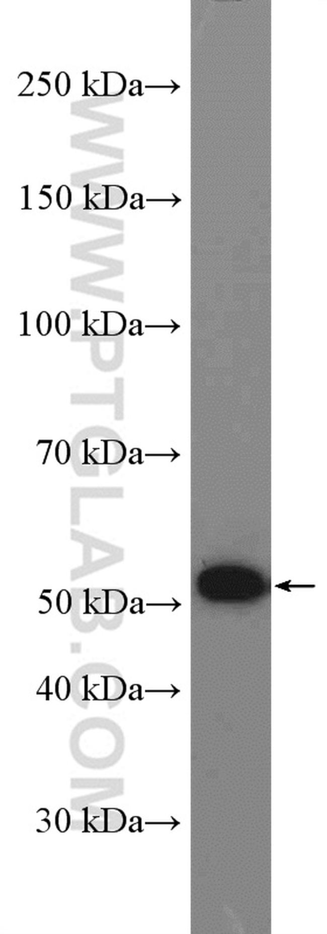 Pancreatic Lipase Antibody in Western Blot (WB)