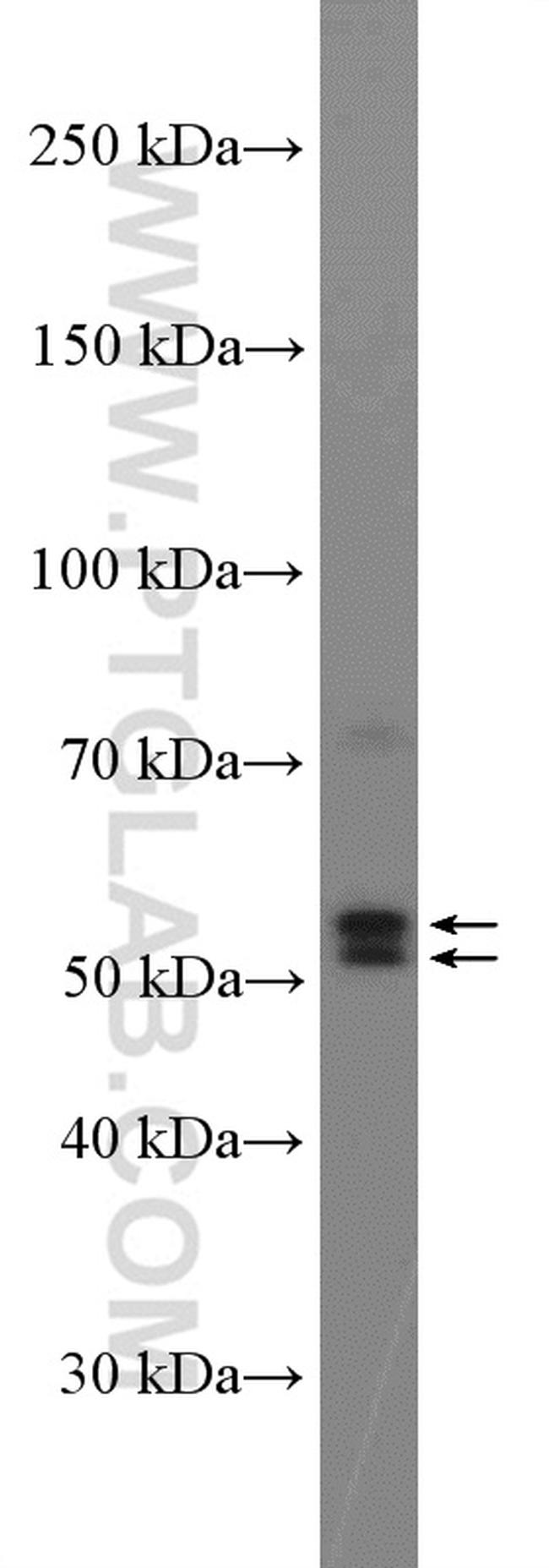 Pancreatic Lipase Antibody in Western Blot (WB)