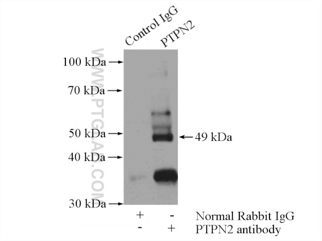 PTPN2 Antibody in Immunoprecipitation (IP)