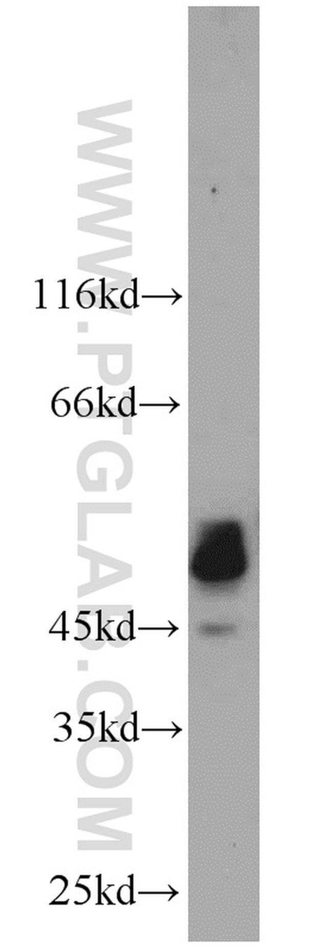 PTPN2 Antibody in Western Blot (WB)