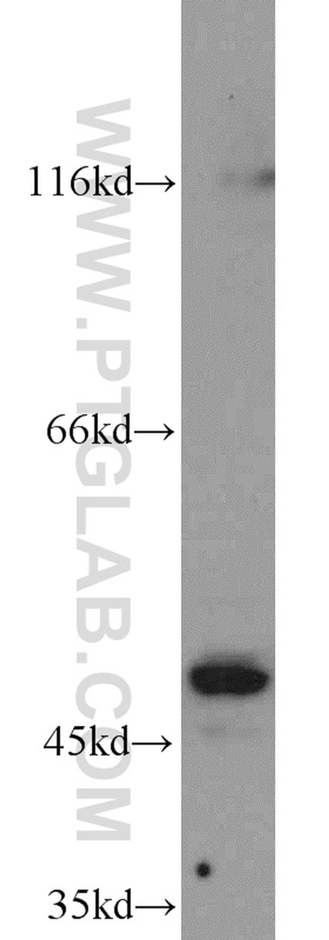 PTPN2 Antibody in Western Blot (WB)