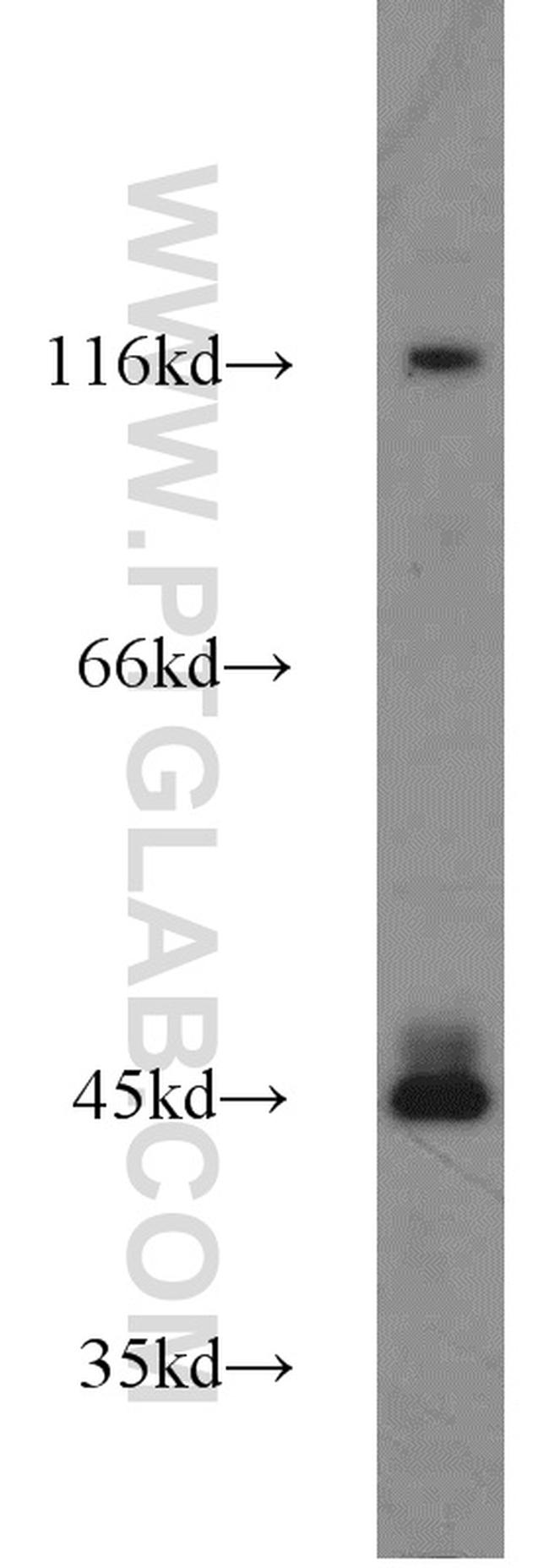 PTPN2 Antibody in Western Blot (WB)