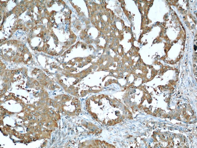 ALDOA Antibody in Immunohistochemistry (Paraffin) (IHC (P))