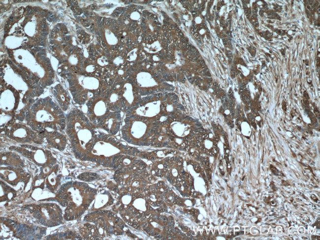 ALDOA Antibody in Immunohistochemistry (Paraffin) (IHC (P))