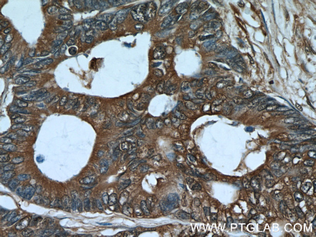 ALDOA Antibody in Immunohistochemistry (Paraffin) (IHC (P))