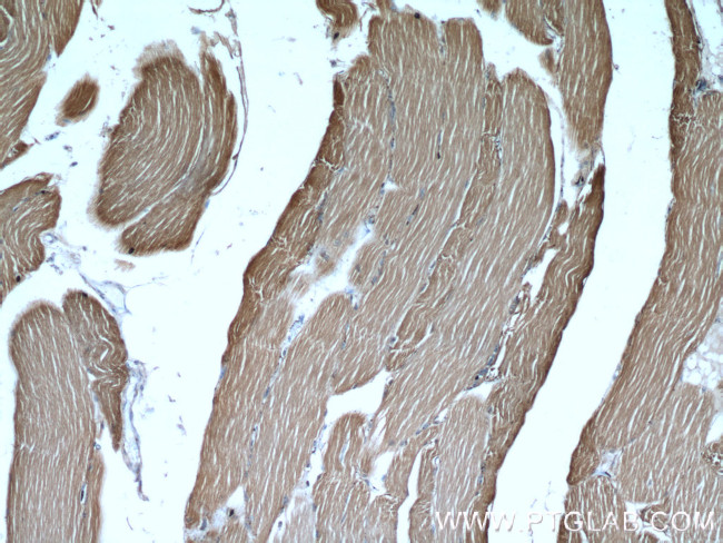 ALDOA Antibody in Immunohistochemistry (Paraffin) (IHC (P))