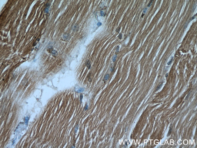 ALDOA Antibody in Immunohistochemistry (Paraffin) (IHC (P))