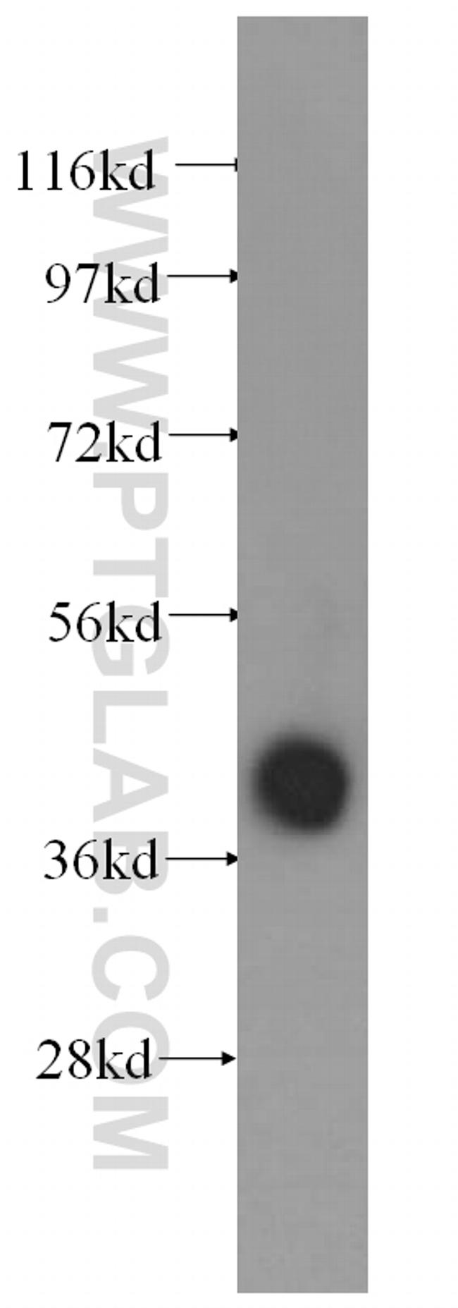 ALDOA Antibody in Western Blot (WB)